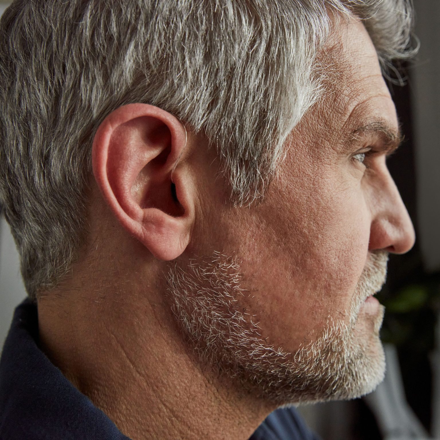 Bose's FDAcleared SoundControl Hearing Aids combines traditional